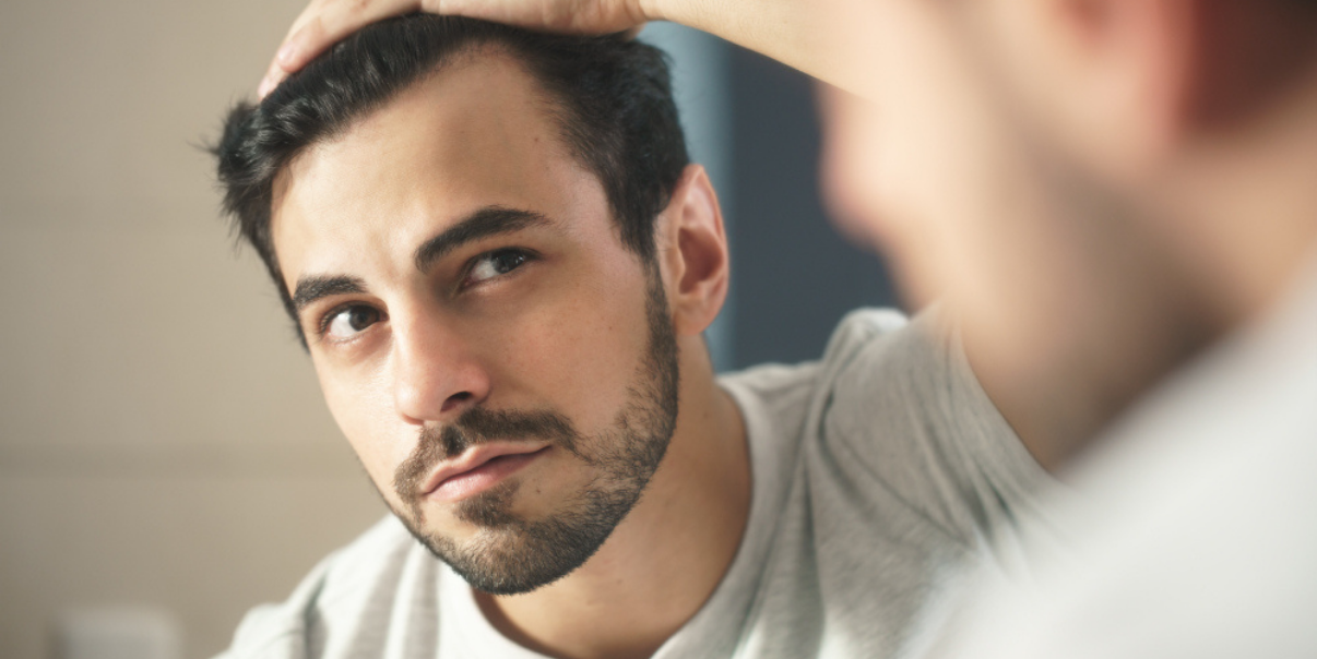 Man checking if his front hairline is a hair replacement giveaway