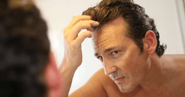 Man deciding if he should perform a hair transplant for men