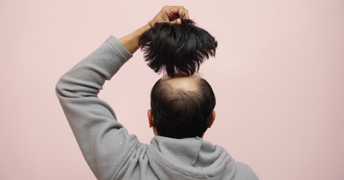 Man putting on his hairpiece (1)