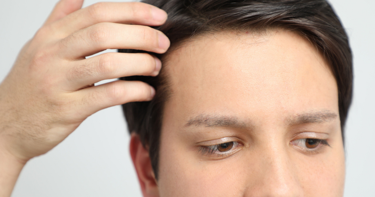 Man wearing a natural-looking hairpiece from Advent Hair (1)