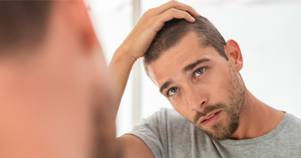 Man worried because of his damaged scalp