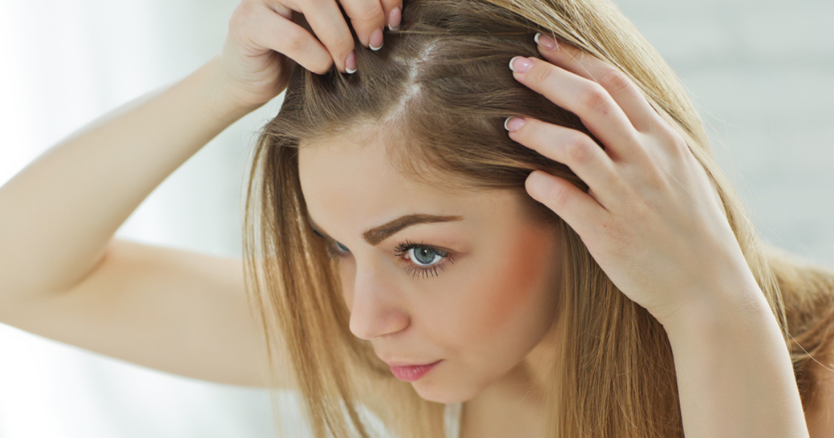 Woman that lost a lot of hair because she suffers hair loss (1)