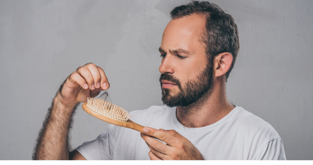 Man struggling with hair loss