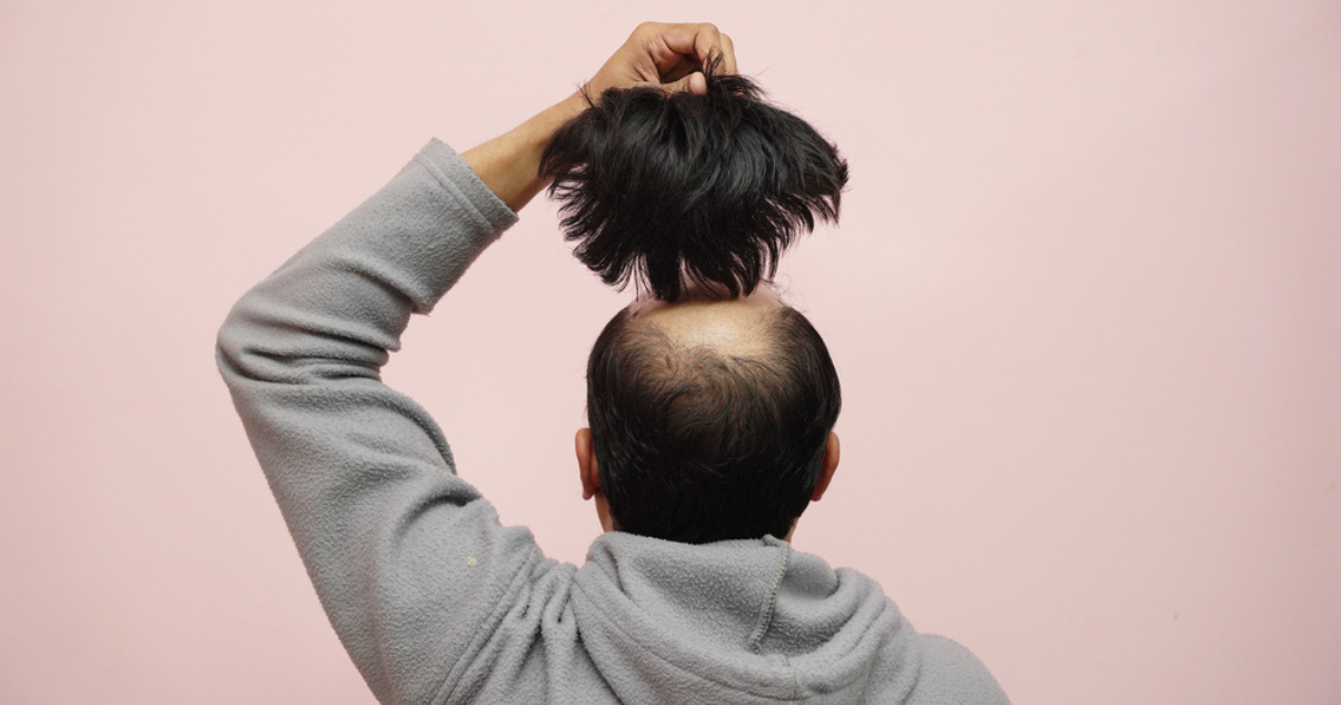 Man putting on his hairpiece