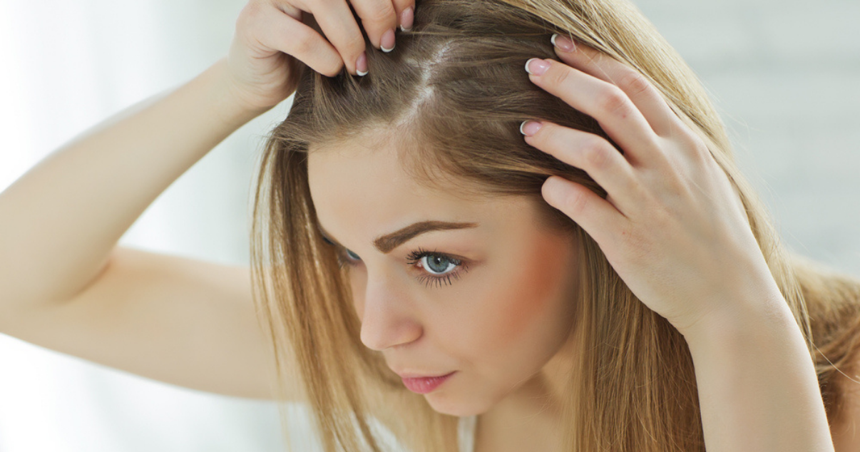 woman with hair loss